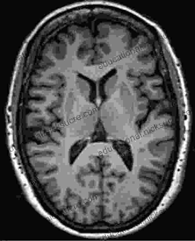 An MRI Scan Of A Teenage Brain, Showing The Different Regions Responsible For Various Cognitive Functions. Inside The Teenage Brain: Parenting A Work In Progress